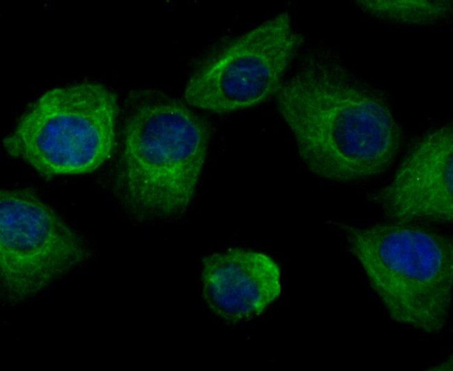 Arp3 Antibody in Immunocytochemistry (ICC/IF)