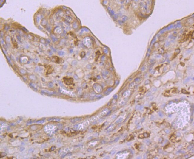 Arp3 Antibody in Immunohistochemistry (Paraffin) (IHC (P))