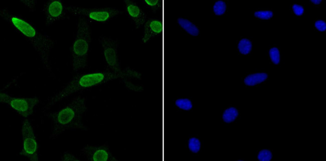 SNRPA Antibody in Immunocytochemistry (ICC/IF)