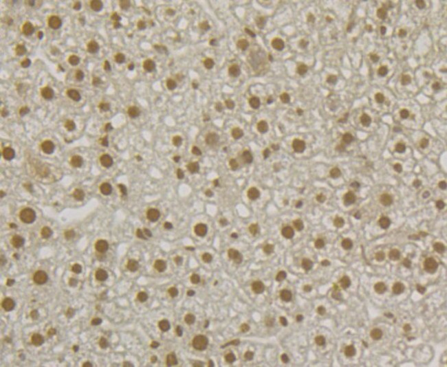 SNRPA Antibody in Immunohistochemistry (Paraffin) (IHC (P))