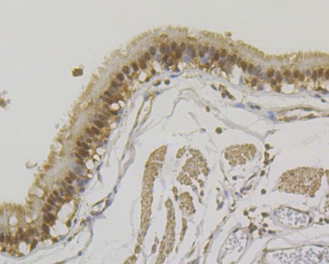 SNRPA Antibody in Immunohistochemistry (Paraffin) (IHC (P))