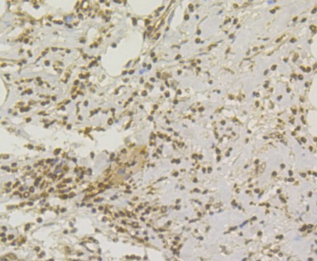 CHD1L Antibody in Immunohistochemistry (Paraffin) (IHC (P))