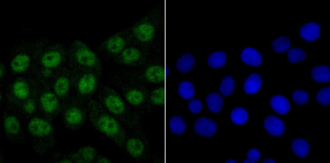 HnRNP Q Antibody in Immunocytochemistry (ICC/IF)