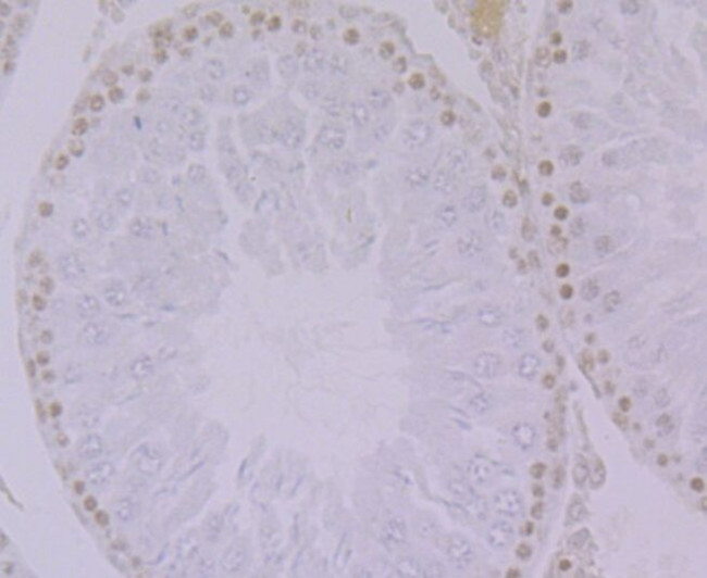 HnRNP Q Antibody in Immunohistochemistry (Paraffin) (IHC (P))