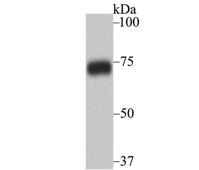 HnRNP Q Antibody in Western Blot (WB)