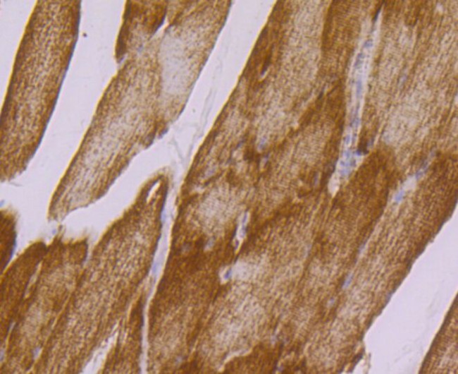 UQCRFS1 Antibody in Immunohistochemistry (Paraffin) (IHC (P))