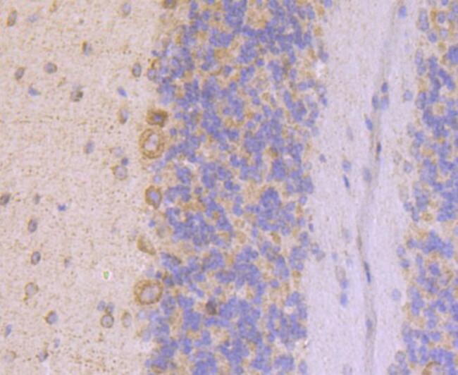 UQCRFS1 Antibody in Immunohistochemistry (Paraffin) (IHC (P))