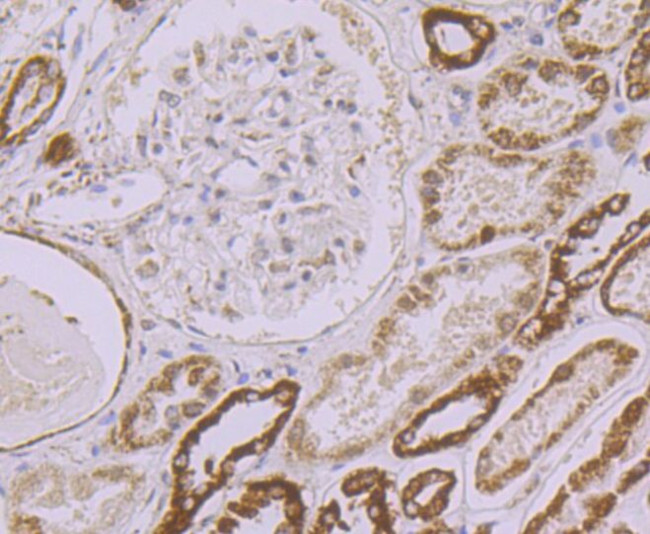 UQCRFS1 Antibody in Immunohistochemistry (Paraffin) (IHC (P))