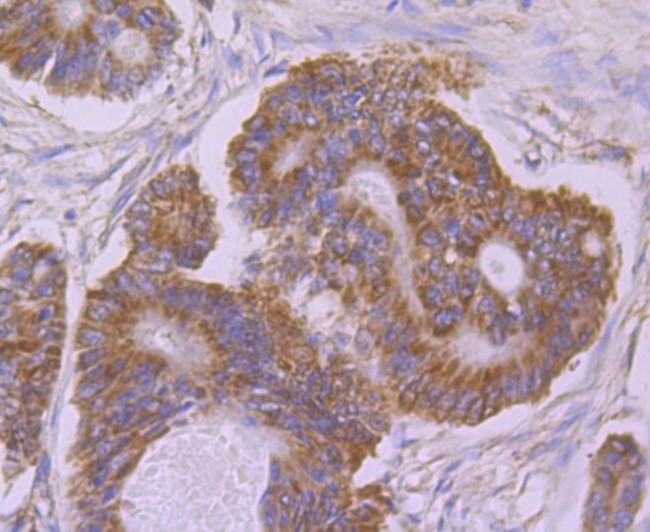 UQCRFS1 Antibody in Immunohistochemistry (Paraffin) (IHC (P))