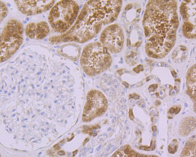 p53DINP1 Antibody in Immunohistochemistry (Paraffin) (IHC (P))