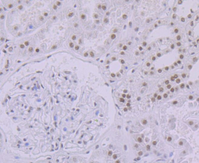 SF3B3 Antibody in Immunohistochemistry (Paraffin) (IHC (P))