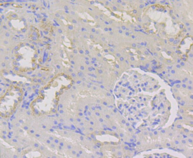 WNK1 Antibody in Immunohistochemistry (Paraffin) (IHC (P))