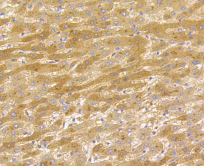 Tetranectin Antibody in Immunohistochemistry (Paraffin) (IHC (P))