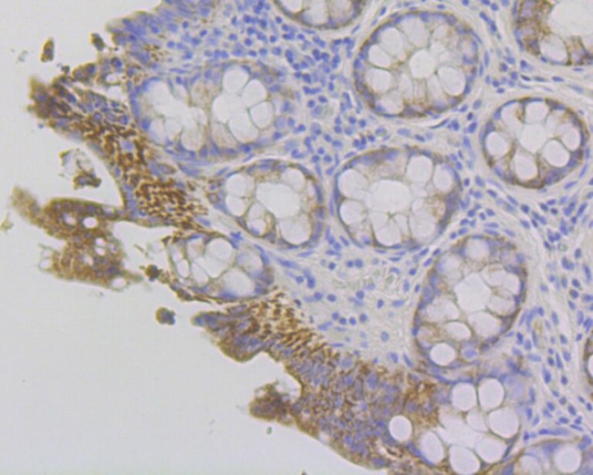 Fibrinogen gamma Antibody in Immunohistochemistry (Paraffin) (IHC (P))