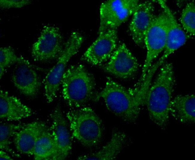 PIST Antibody in Immunocytochemistry (ICC/IF)