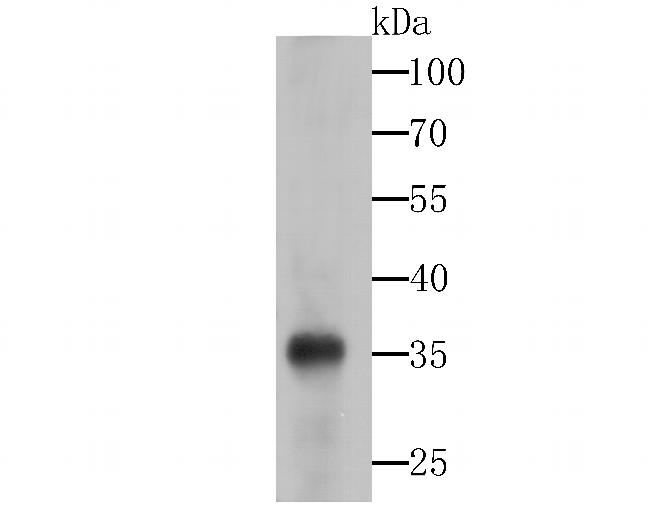 SMN1 Antibody in Western Blot (WB)