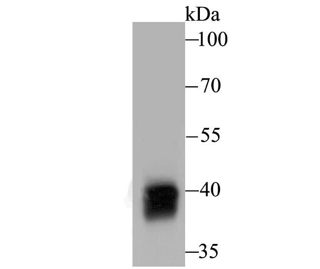 Alcohol Dehydrogenase 1A Antibody in Western Blot (WB)