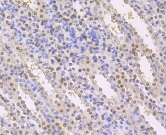 CBF beta Antibody in Immunohistochemistry (Paraffin) (IHC (P))