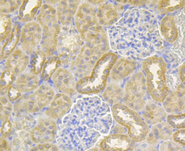 NDUFS4 Antibody in Immunohistochemistry (Paraffin) (IHC (P))