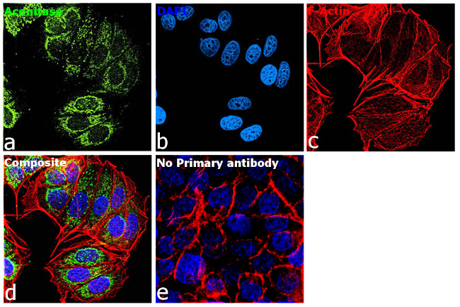 Aconitase 2 Antibody in Immunocytochemistry (ICC/IF)