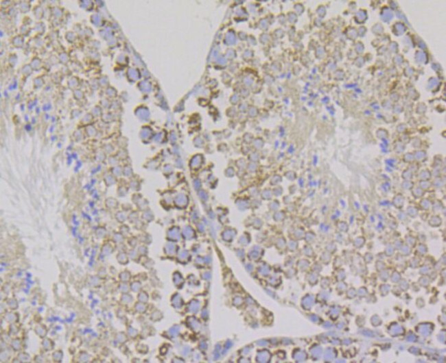 Aconitase 2 Antibody in Immunohistochemistry (Paraffin) (IHC (P))