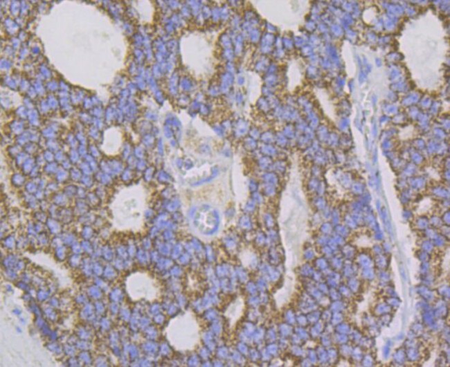 Aconitase 2 Antibody in Immunohistochemistry (Paraffin) (IHC (P))