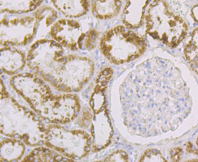 Aconitase 2 Antibody in Immunohistochemistry (Paraffin) (IHC (P))