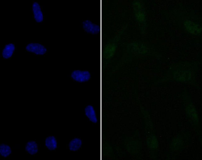 BAF57 Antibody in Immunocytochemistry (ICC/IF)