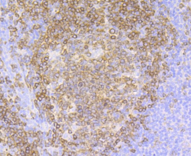 CD79a Antibody in Immunohistochemistry (Paraffin) (IHC (P))