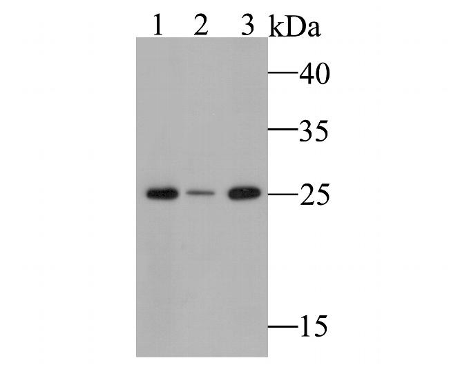 GSTK1 Antibody in Western Blot (WB)