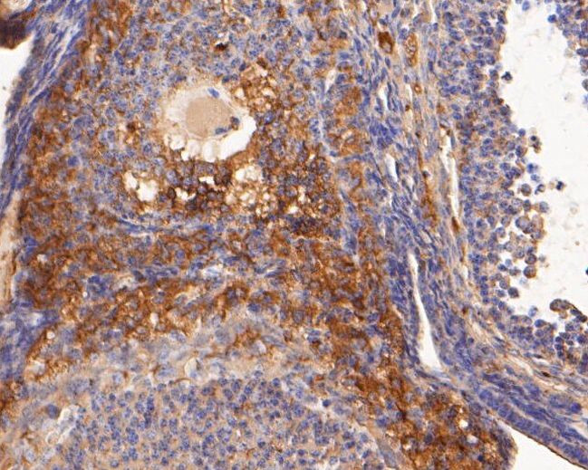 BMP-15 Antibody in Immunohistochemistry (Paraffin) (IHC (P))