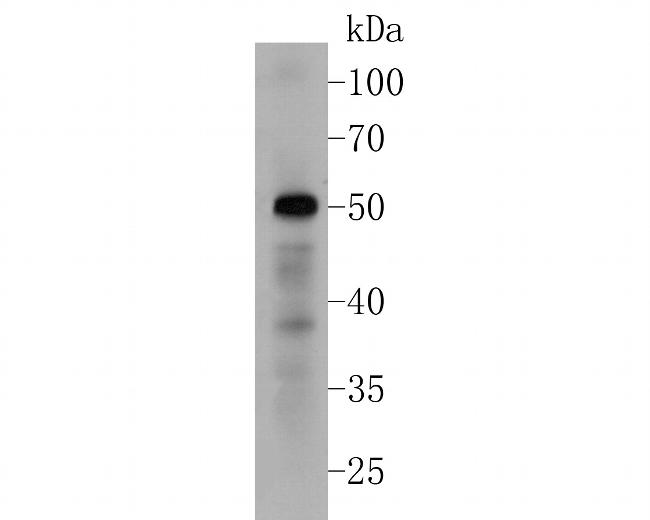 BMP-15 Antibody in Western Blot (WB)