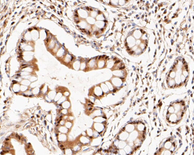 LTA4H Antibody in Immunohistochemistry (Paraffin) (IHC (P))