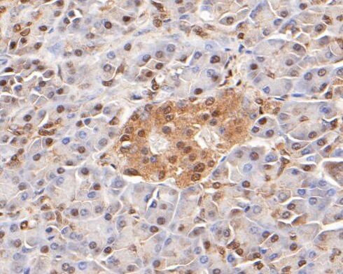 LTA4H Antibody in Immunohistochemistry (Paraffin) (IHC (P))