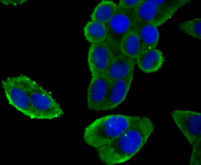 SCN9A Antibody in Immunocytochemistry (ICC/IF)