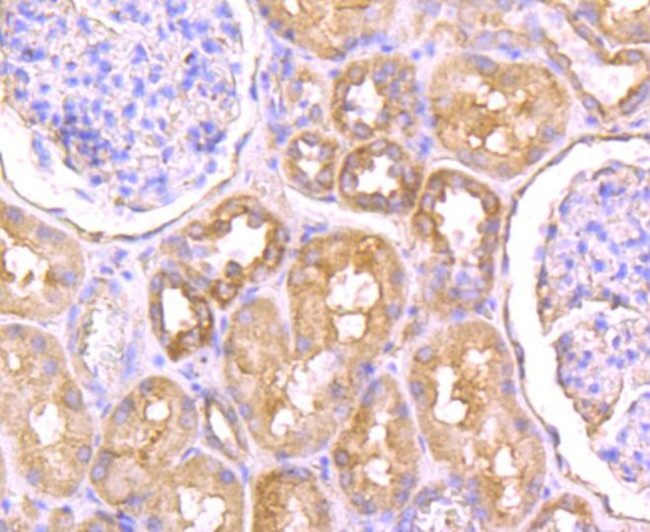 SCN9A Antibody in Immunohistochemistry (Paraffin) (IHC (P))