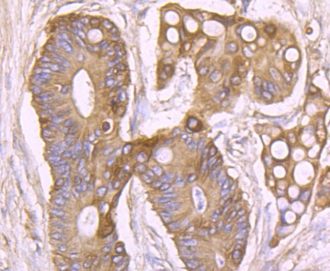 SCN9A Antibody in Immunohistochemistry (Paraffin) (IHC (P))