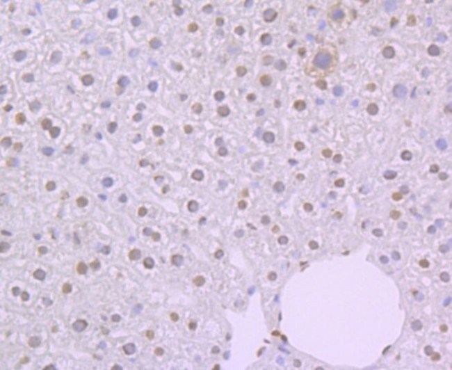 NFIB Antibody in Immunohistochemistry (Paraffin) (IHC (P))