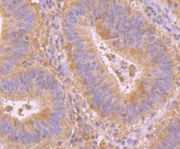 PRDX6 Antibody in Immunohistochemistry (Paraffin) (IHC (P))