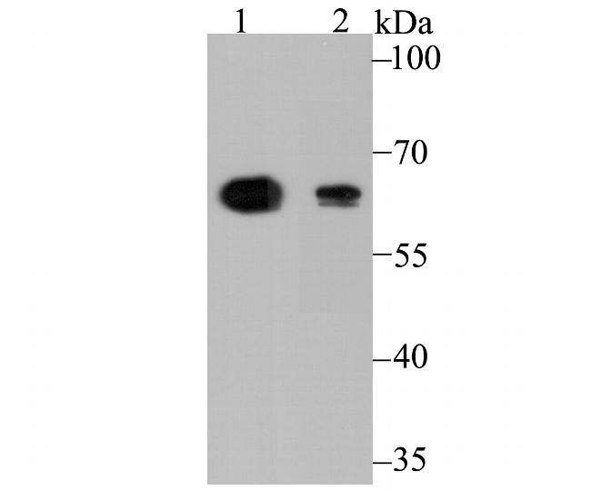 ALDH4A1 Antibody in Western Blot (WB)