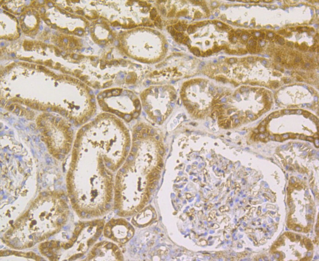 GPX1 Antibody in Immunohistochemistry (Paraffin) (IHC (P))