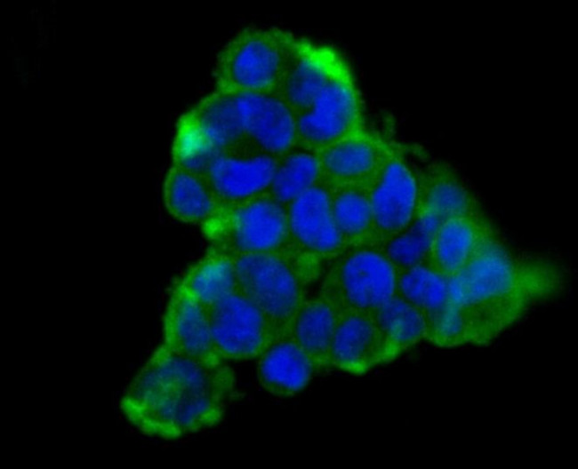 Carbonic Anhydrase II Antibody in Immunocytochemistry (ICC/IF)