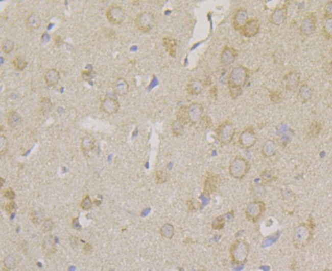 Carbonic Anhydrase II Antibody in Immunohistochemistry (Paraffin) (IHC (P))