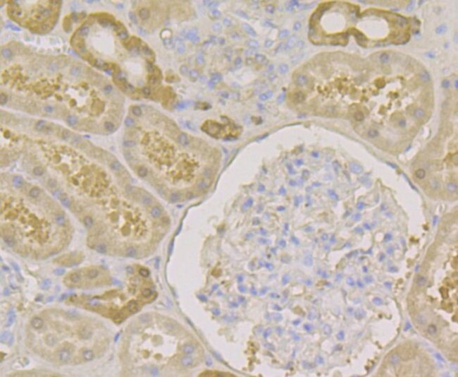 Carbonic Anhydrase II Antibody in Immunohistochemistry (Paraffin) (IHC (P))