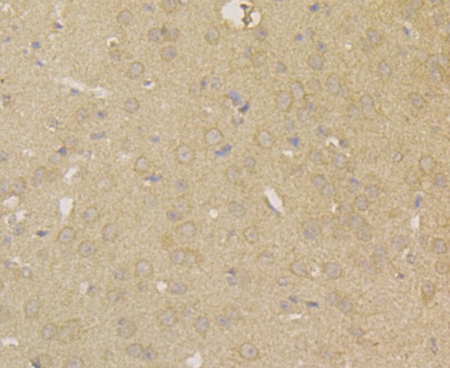 Carbonic Anhydrase II Antibody in Immunohistochemistry (Paraffin) (IHC (P))