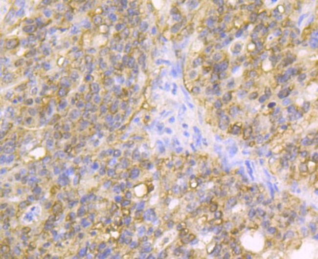 Carbonic Anhydrase II Antibody in Immunohistochemistry (Paraffin) (IHC (P))