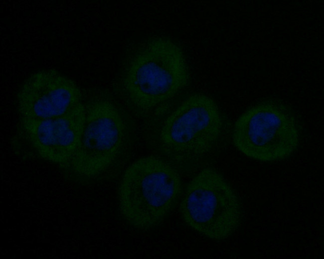 Stathmin 1 Antibody in Immunocytochemistry (ICC/IF)