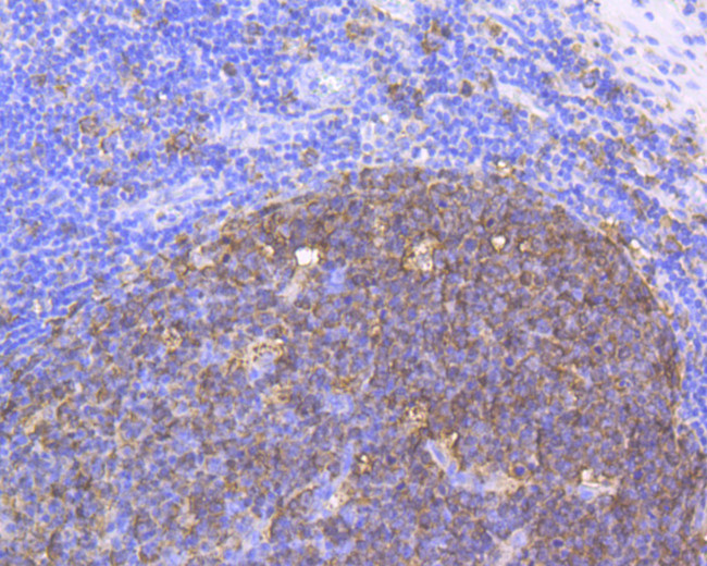 Stathmin 1 Antibody in Immunohistochemistry (Paraffin) (IHC (P))