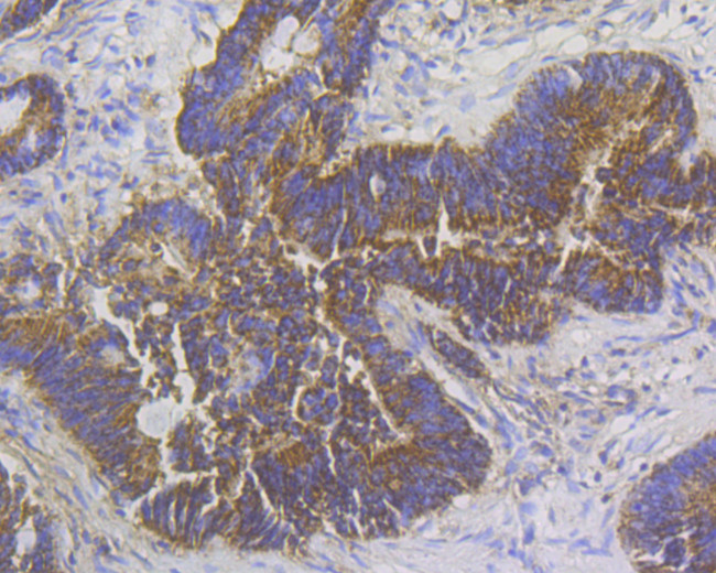 Stathmin 1 Antibody in Immunohistochemistry (Paraffin) (IHC (P))