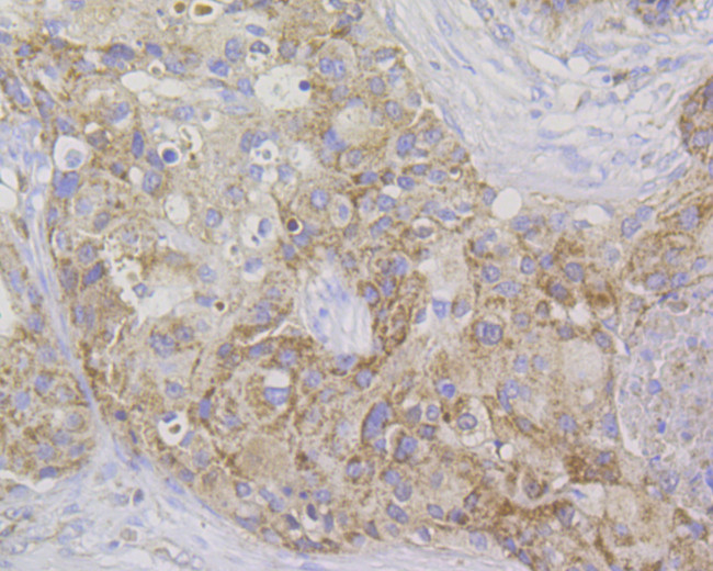 Stathmin 1 Antibody in Immunohistochemistry (Paraffin) (IHC (P))